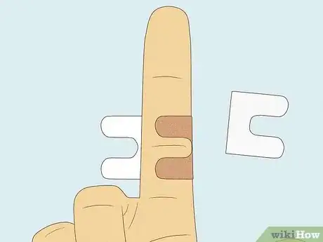 Image titled Apply Different Types of Bandages Step 11