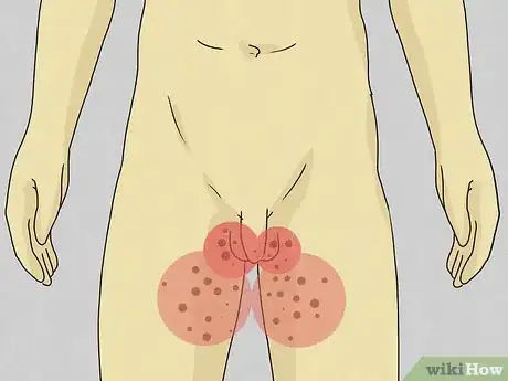 Image titled Untuck Your Balls Step 10