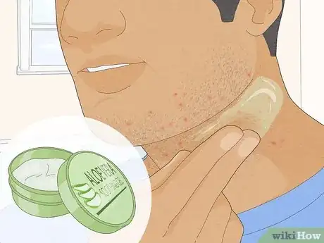 Image titled Get Rid of Razor Bumps on Your Neck Step 2