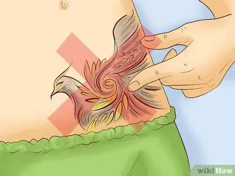 Image titled Get Rid of Tattoo Scarring and Blowouts Step 13