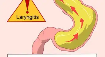 Treat Laryngitis