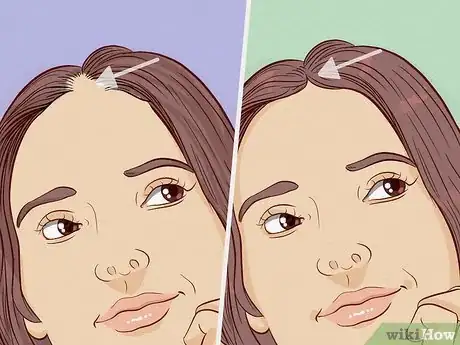 Image titled Regrow Hair After Hair Loss (Women) Step 15