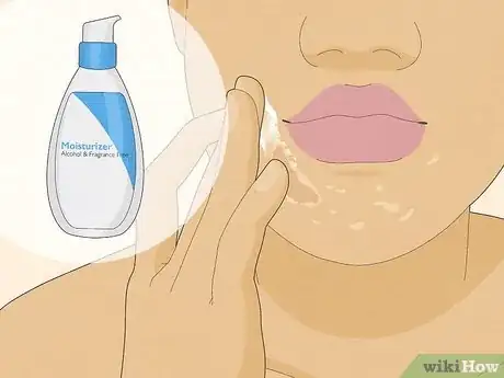 Image titled Get Rid of Peeling Skin Step 1