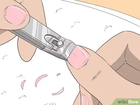 Image titled Get Rid of Psoriasis on Your Nails Step 10