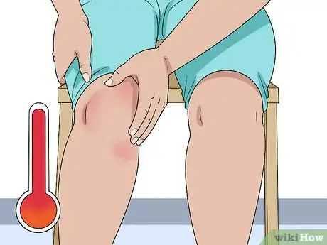 Image titled Keep Your Knees from Popping and Cracking Step 13