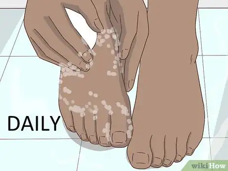 Image titled Stop Your Feet from Sweating Step 1