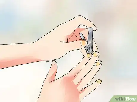 Image titled Know if You Have Nail Fungus Step 8