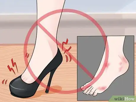 Image titled Prevent Foot Blisters Step 2