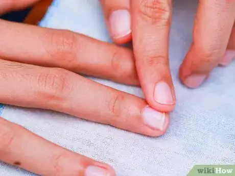 Image titled Prevent Hangnails Step 1