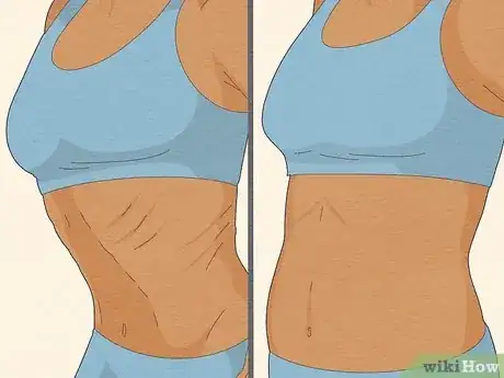 Image titled Do the Stomach Vacuum Exercise Step 7