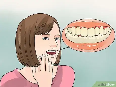 Image titled Determine if a Tooth Needs to Be Pulled Step 1