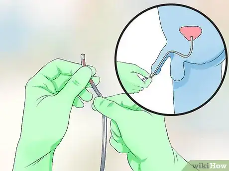 Image titled Use a Catheter Step 12