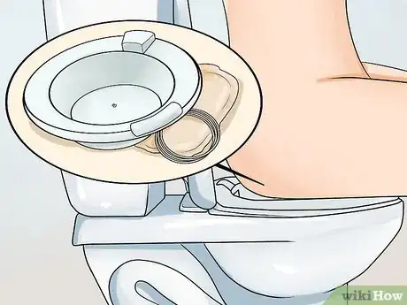 Image titled Cure Hemorrhoids or Piles Step 2
