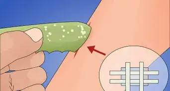 Make a Quick Disinfectant for Minor Cuts and Abrasions