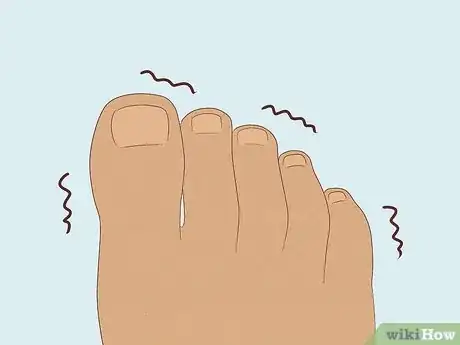 Image titled Treat Trench Foot Step 5