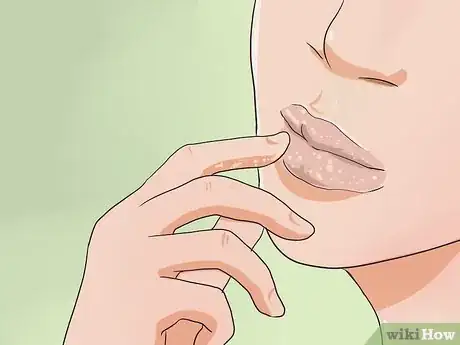 Image titled Get Big Lips Step 1