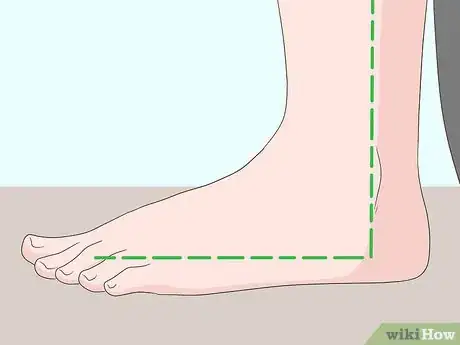 Image titled Wrap an Ankle with an ACE Bandage Step 2