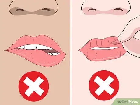 Image titled Have Healthy Lips Step 2