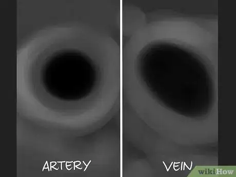 Image titled Tell the Difference Between Arteries and Veins Step 9