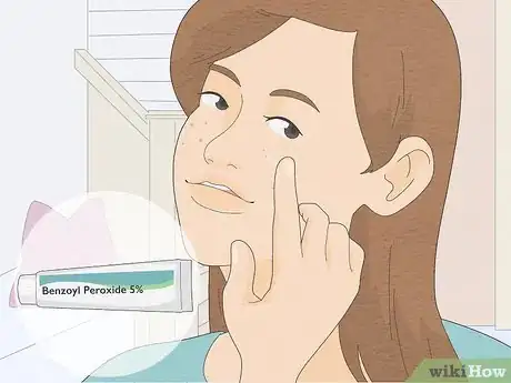 Image titled Get Rid of Pimples with Baking Soda Step 5