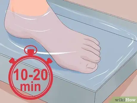 Image titled Remove Infection from an Ingrown Toenail Step 1