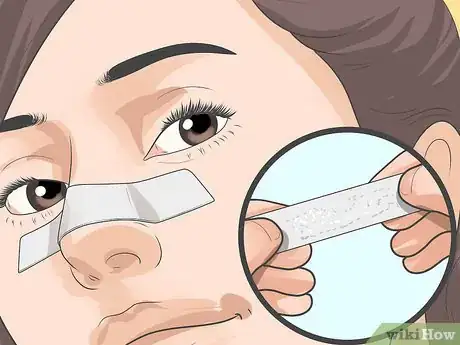 Image titled Get Rid of Acne on Your Nose Step 4