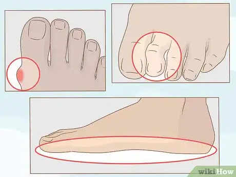 Image titled Get Healthy, Clean and Good Looking Feet Step 16