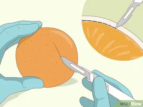 Image titled Practice Surgery Skills on Fruit Step 1