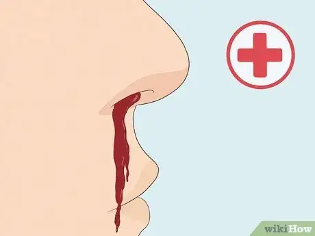 Image titled Stop a Nosebleed with a Penny Step 10