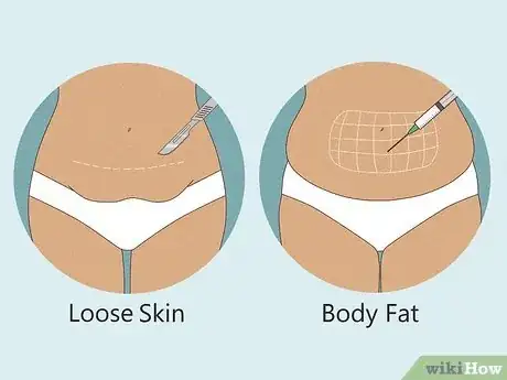 Image titled Tell the Difference Between Fat and Loose Skin Step 12