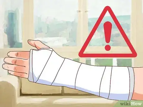 Image titled Treat an Open Fracture During First Aid Step 14