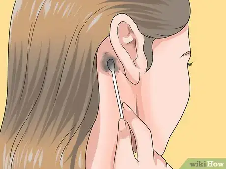 Image titled Get White Hair Step 15