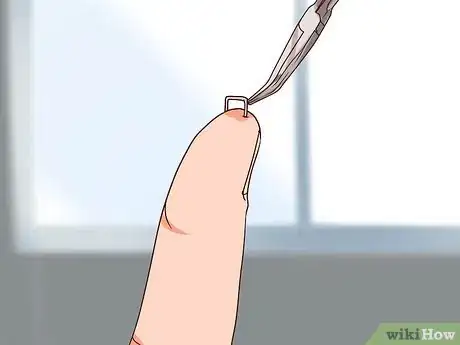 Image titled Remove a Staple from Your Hand Step 3