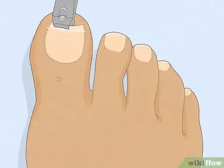 Image titled Have Pretty Toenails Step 5