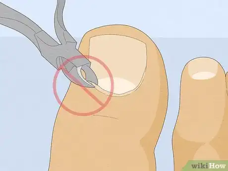 Image titled Have Pretty Toenails Step 7