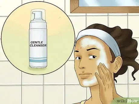 Image titled Get Rid of Forehead Acne Step 14