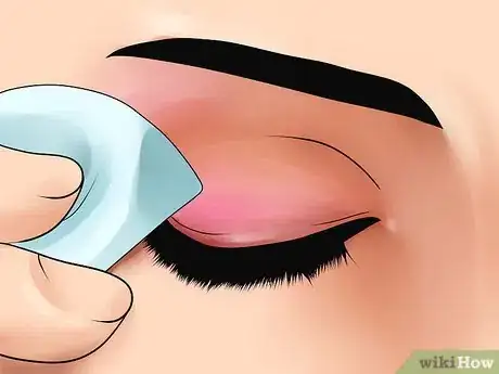 Image titled Reduce Bags Under Your Eyes Step 1