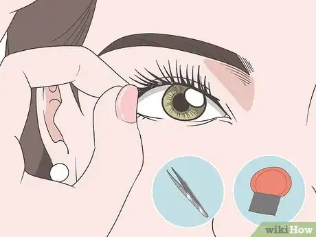 Image titled Treat Eyebrow and Eyelash Lice Step 6