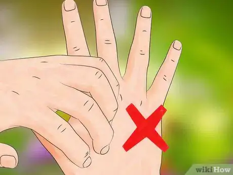 Image titled Get Bug Bites to Stop Itching Step 18