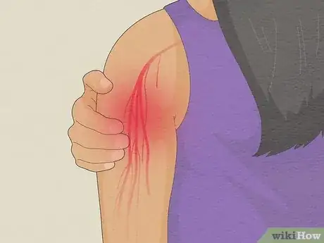 Image titled Know if Left Arm Pain Is Heart Related Step 5