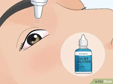 Image titled Make Your Eyes Stop Hurting after Swimming Step 2