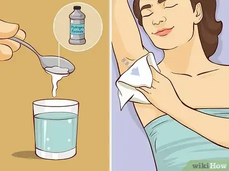 Image titled Stop Underarm Odor Step 8