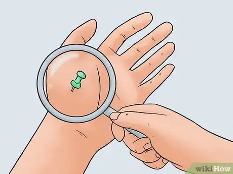 Image titled Remove a Pin or Tack from Your Skin Step 3