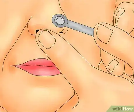 Image titled Remove Blackheads and Whiteheads with a Comedo Extractor Step 5