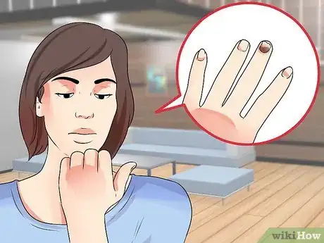 Image titled Know if You Have Nail Fungus Step 4