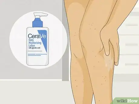 Image titled Get Rid of Razor Burn Fast Step 2