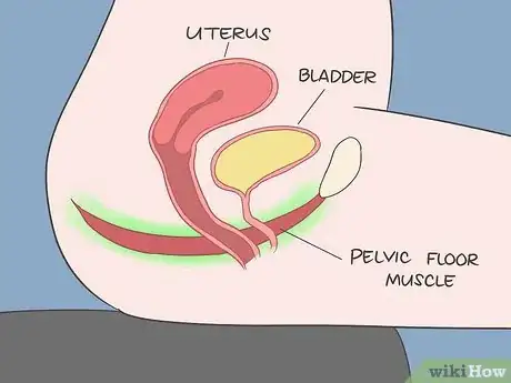 Image titled Strengthen Bowel Muscles Step 5