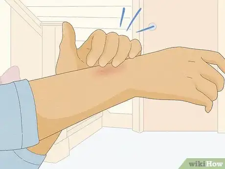 Image titled Remove Iodine Stains from Skin Step 5