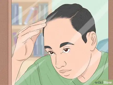 Image titled Know if You Have Male Pattern Baldness Step 11