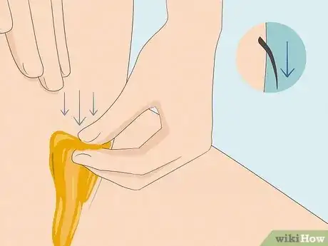 Image titled Give Yourself a Brazilian Wax Step 12